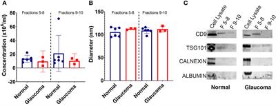 Comparison of the extracellular vesicle proteome between glaucoma and non-glaucoma trabecular meshwork cells